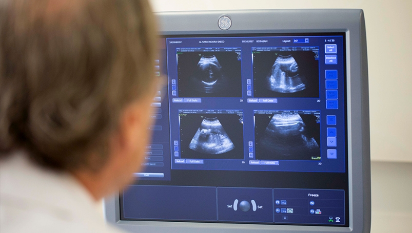 fetalimaging1